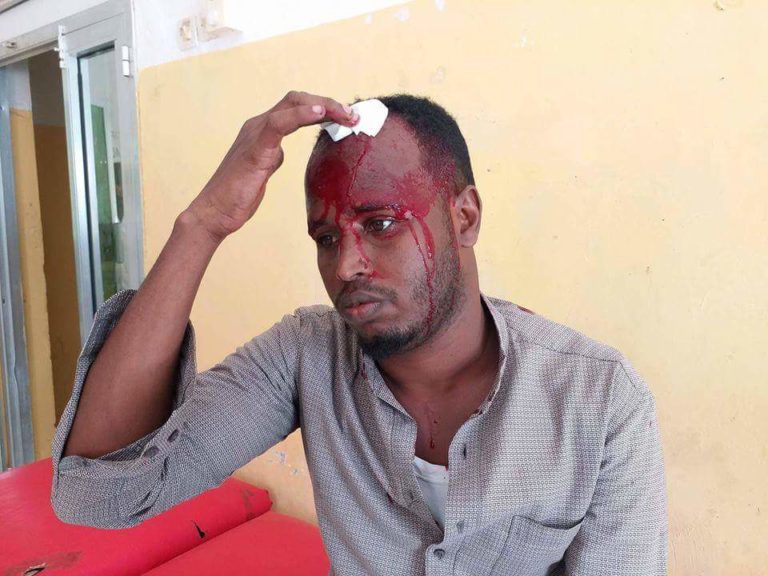 AFEX Bemoans Recent Attacks on Journalists in Somalia